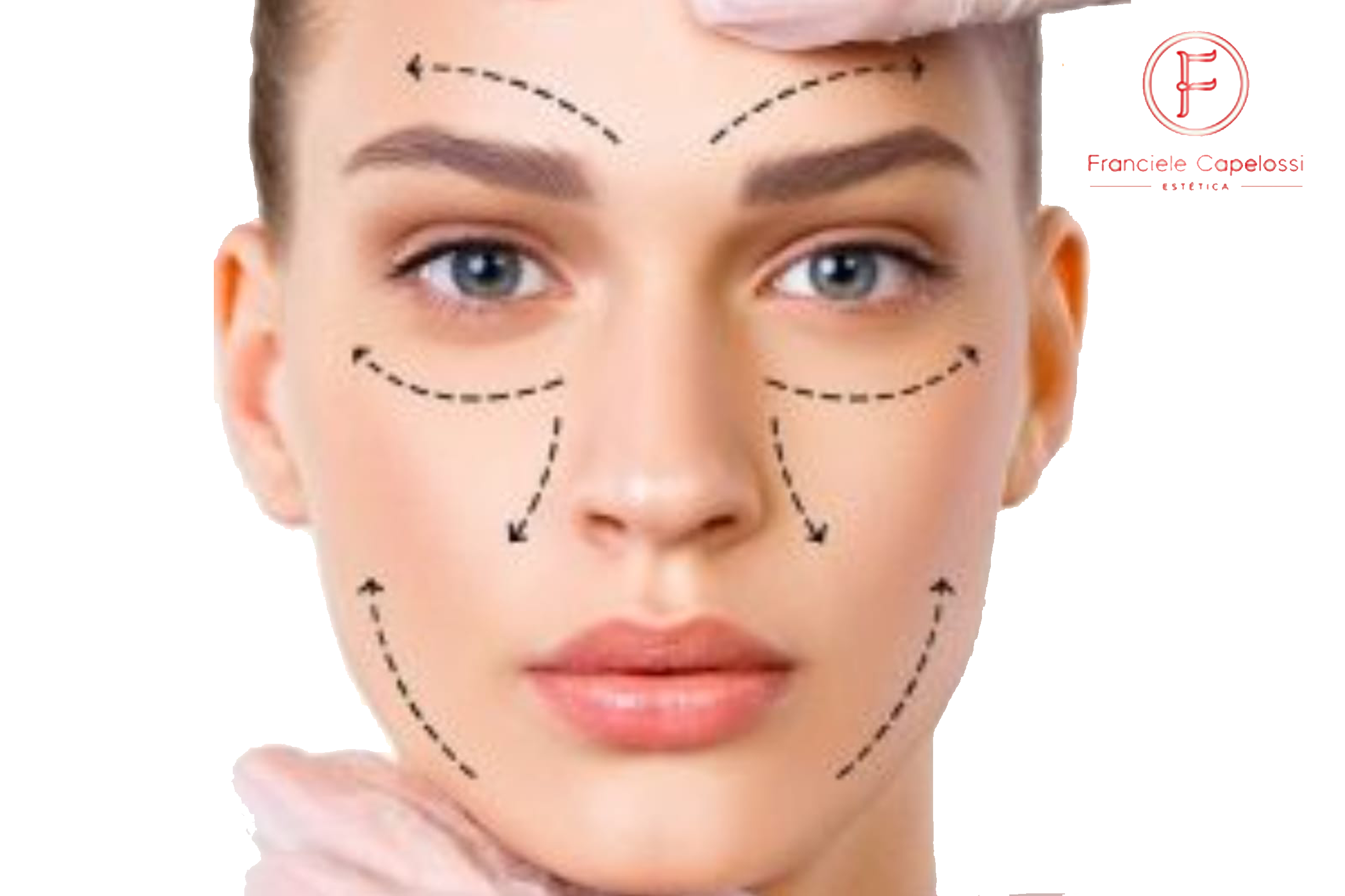 Microagulhamento para Rejuvenescimento + Vitamina C + Microbotox